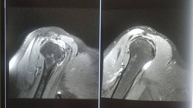Nicht auf die leichte Schulter nehmen…